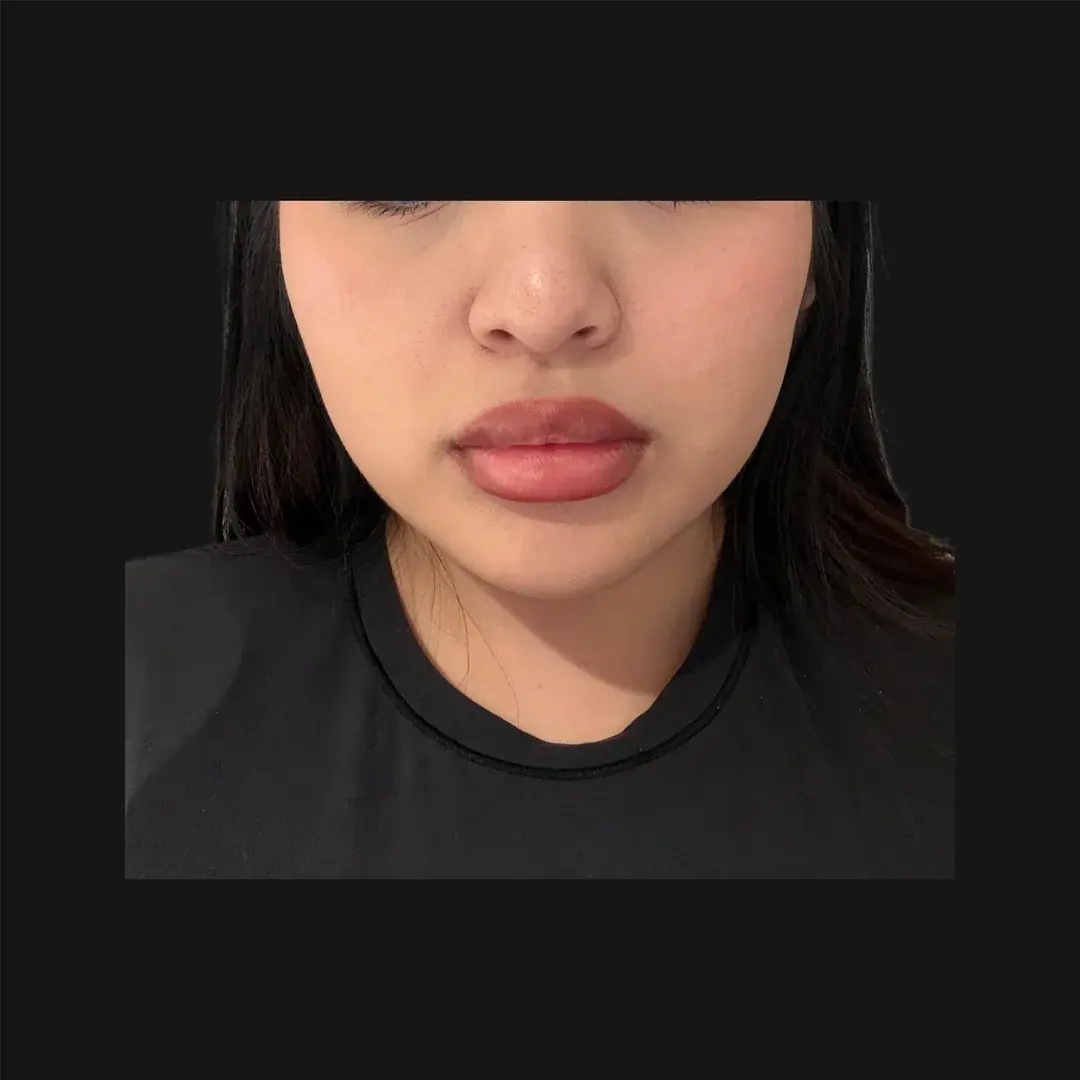 MIHO Plastic Surgery — 1
