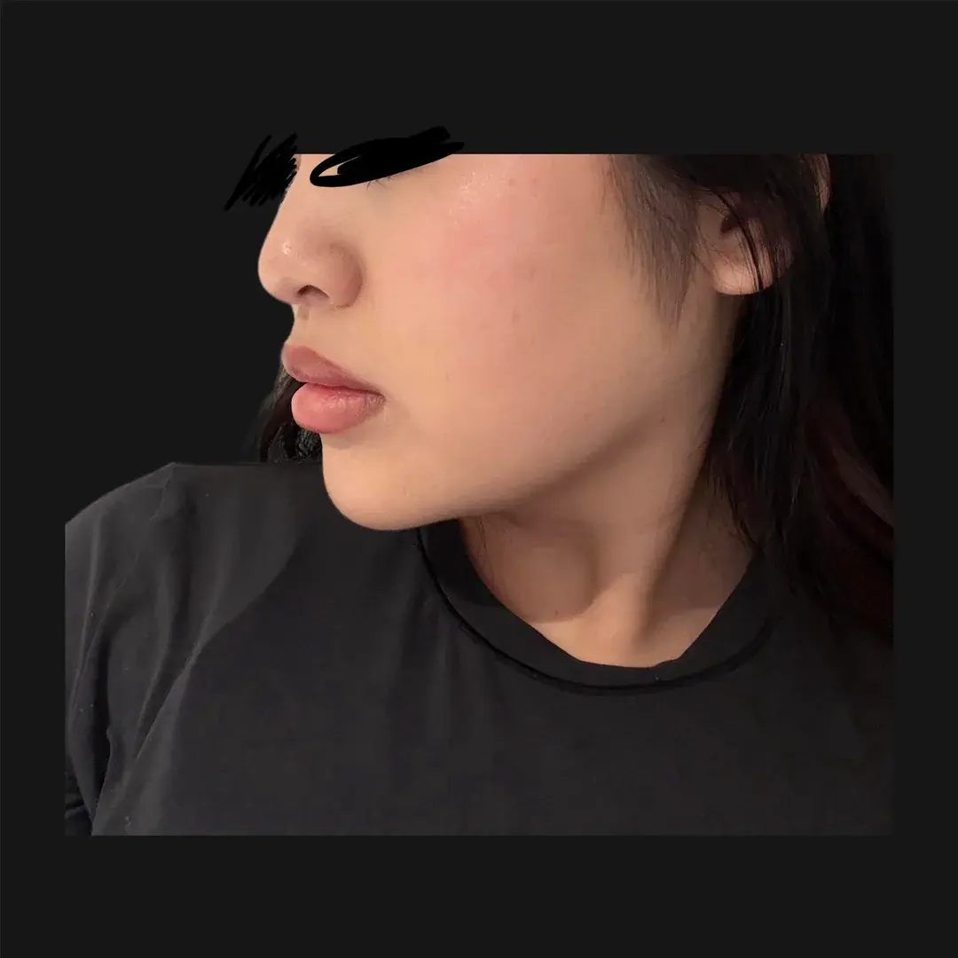MIHO Plastic Surgery — 2