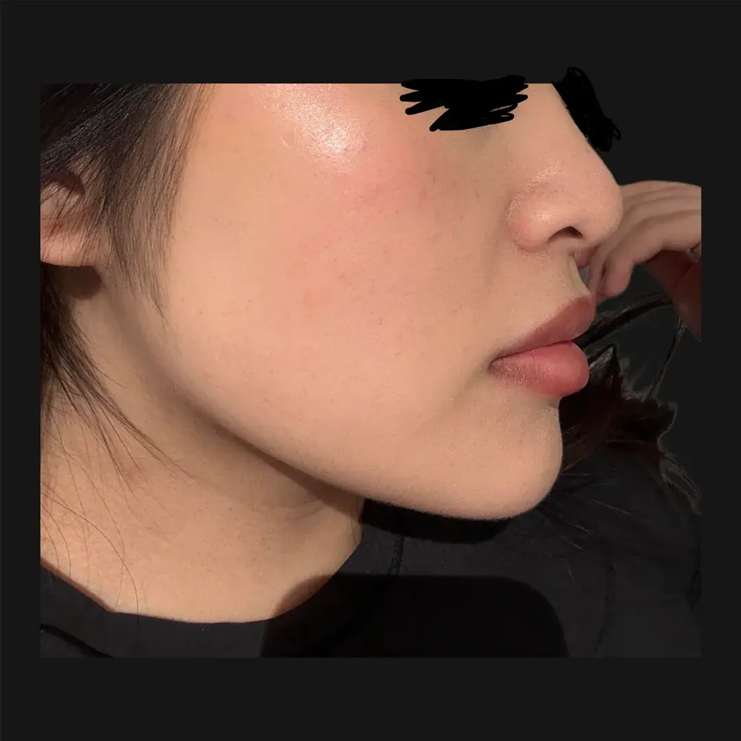 MIHO Plastic Surgery — 3