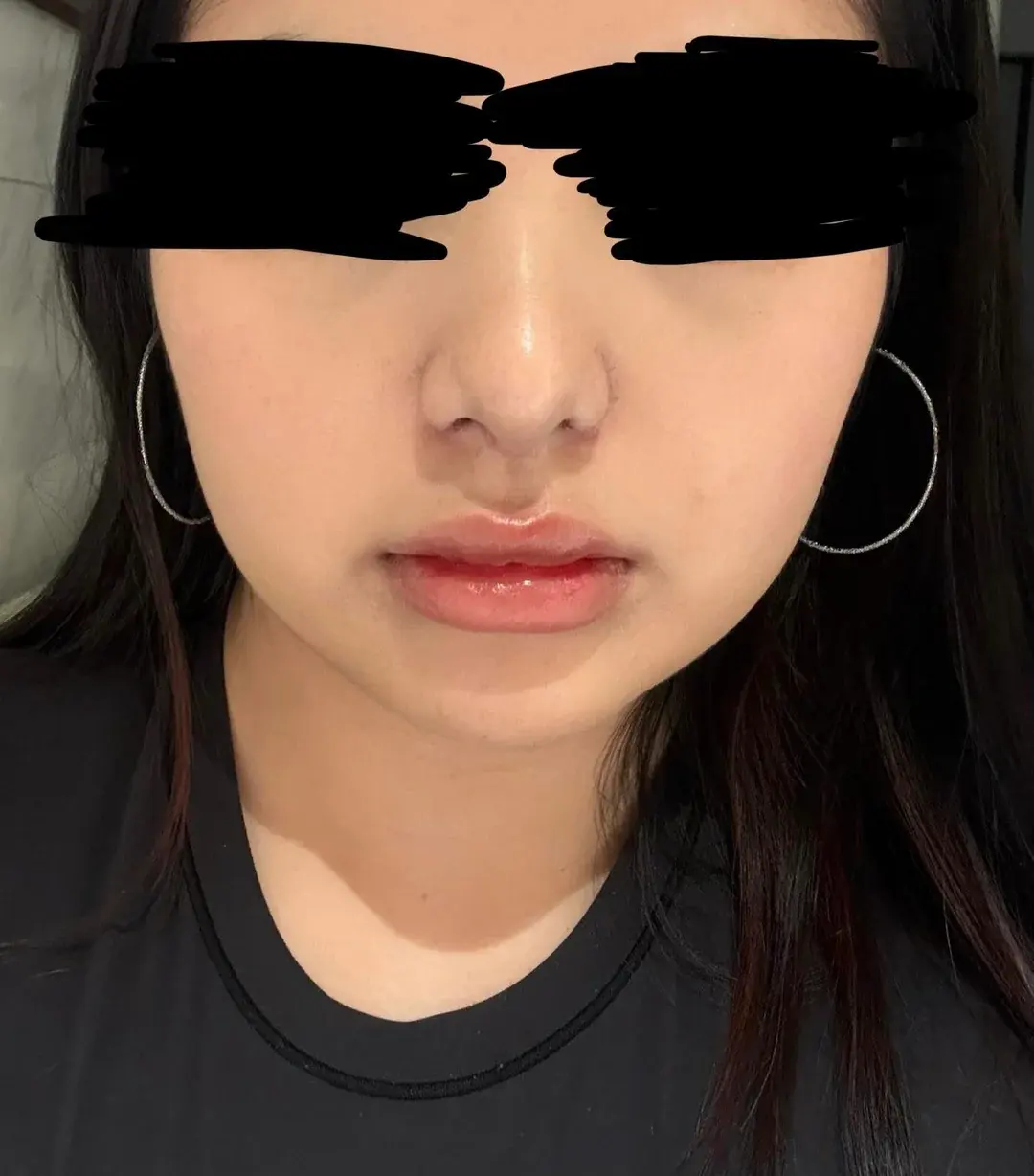 MIHO Plastic Surgery — 4