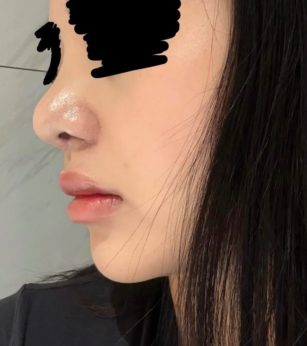 MIHO Plastic Surgery — 5