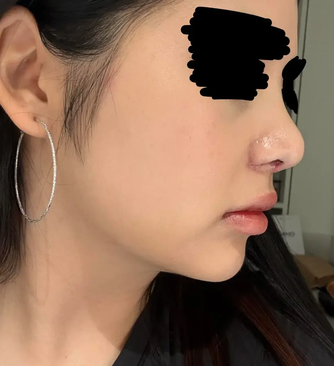 MIHO Plastic Surgery — 6