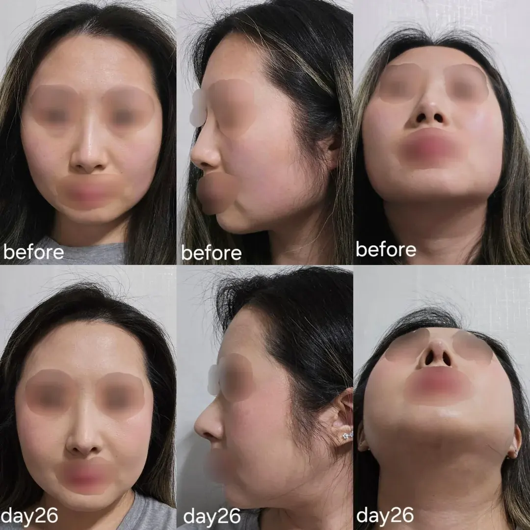 AB Plastic Surgery — 1