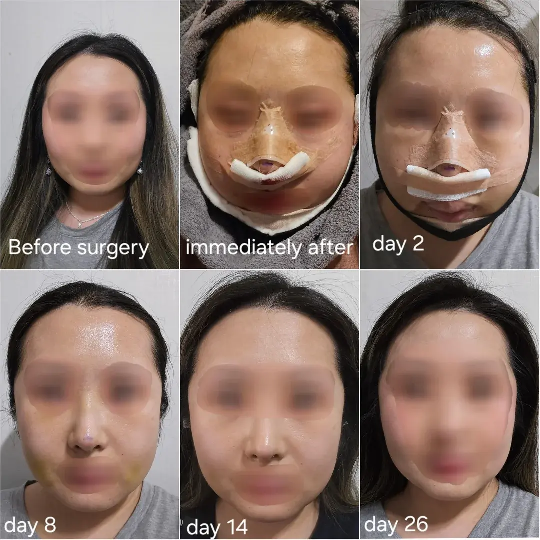 AB Plastic Surgery — 3
