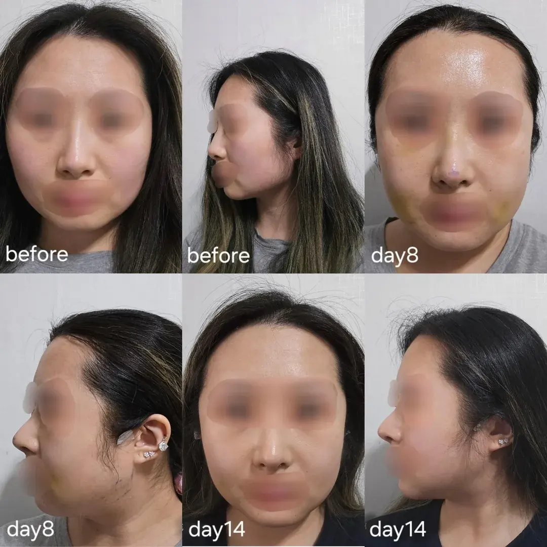 AB Plastic Surgery — 4