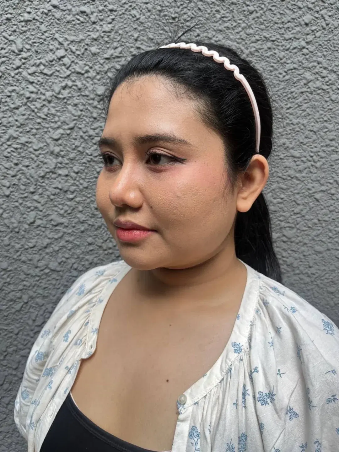 MOOi Plastic Surgery — 4