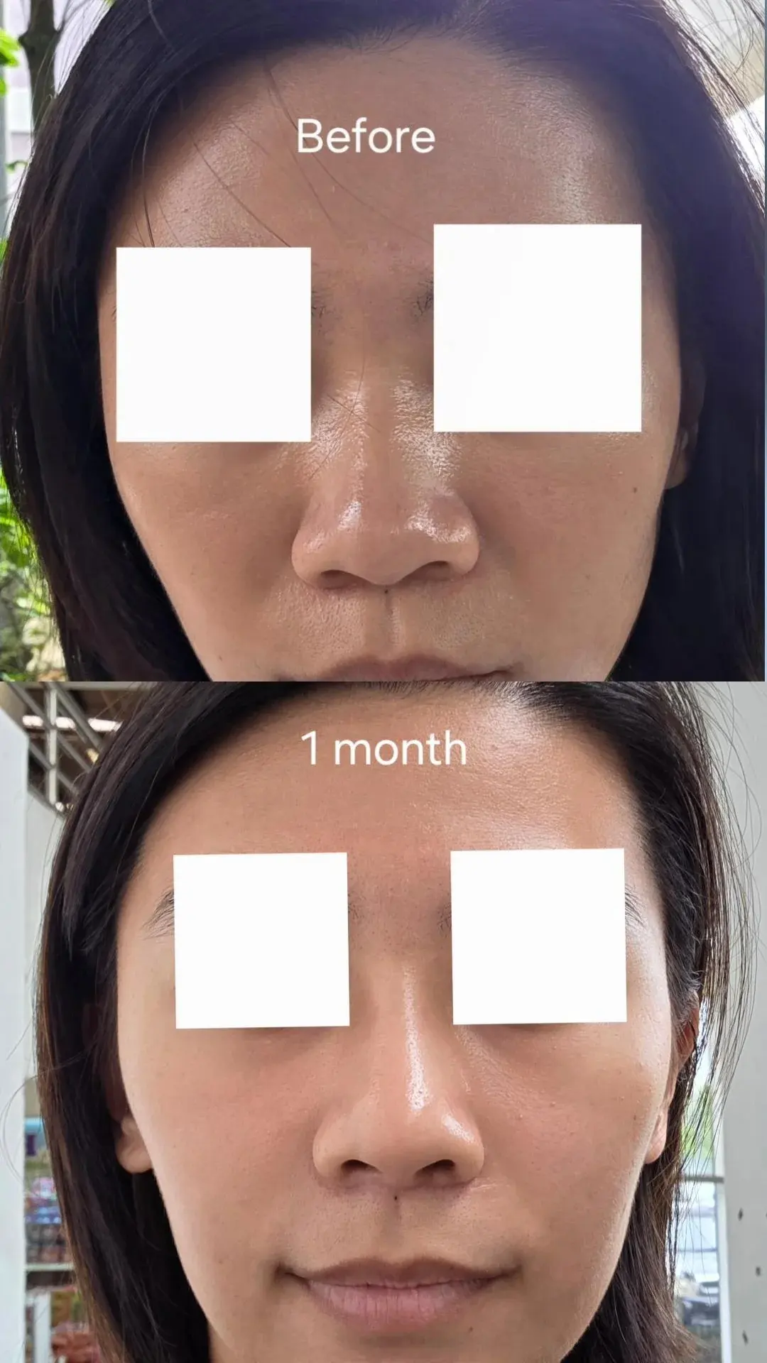 NPLUS Clinic — 1