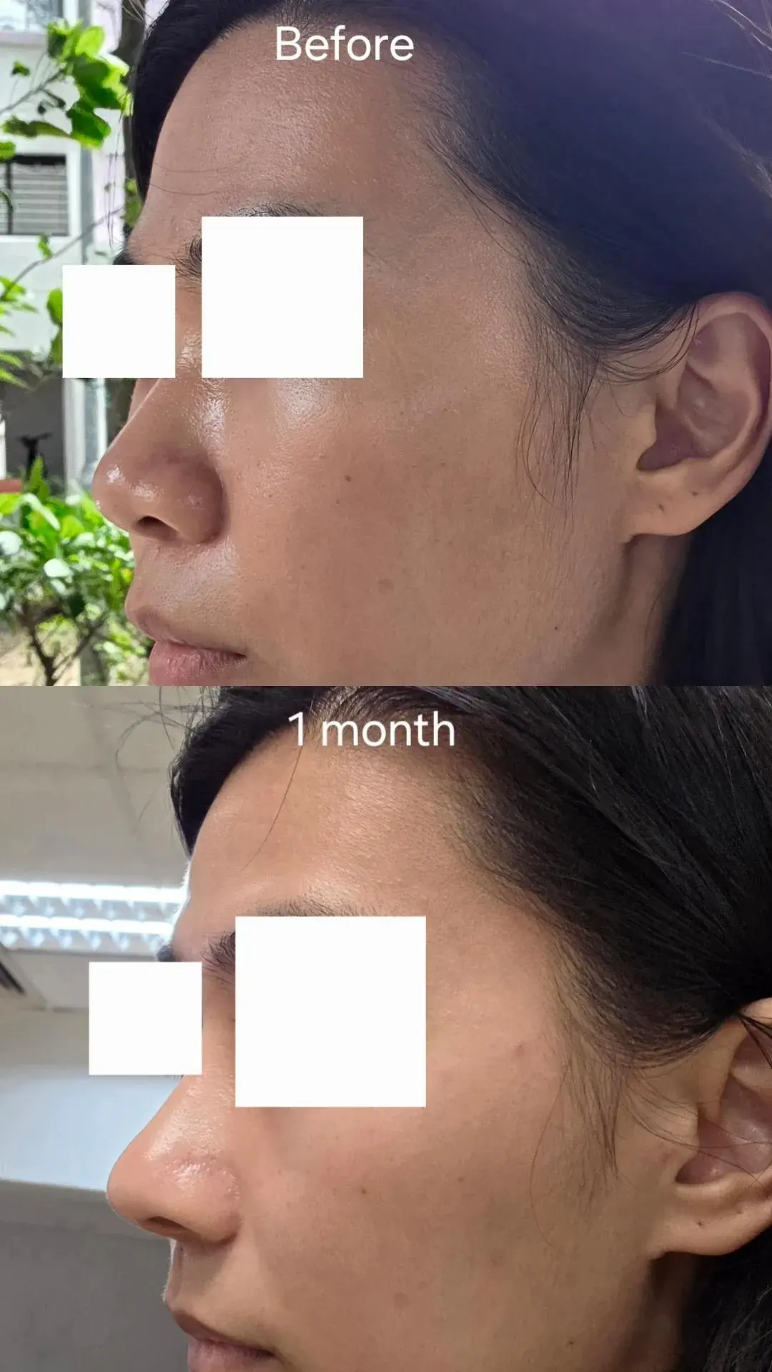 NPLUS Clinic — 2