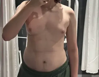 Silhouette Plastic Surgery — 2