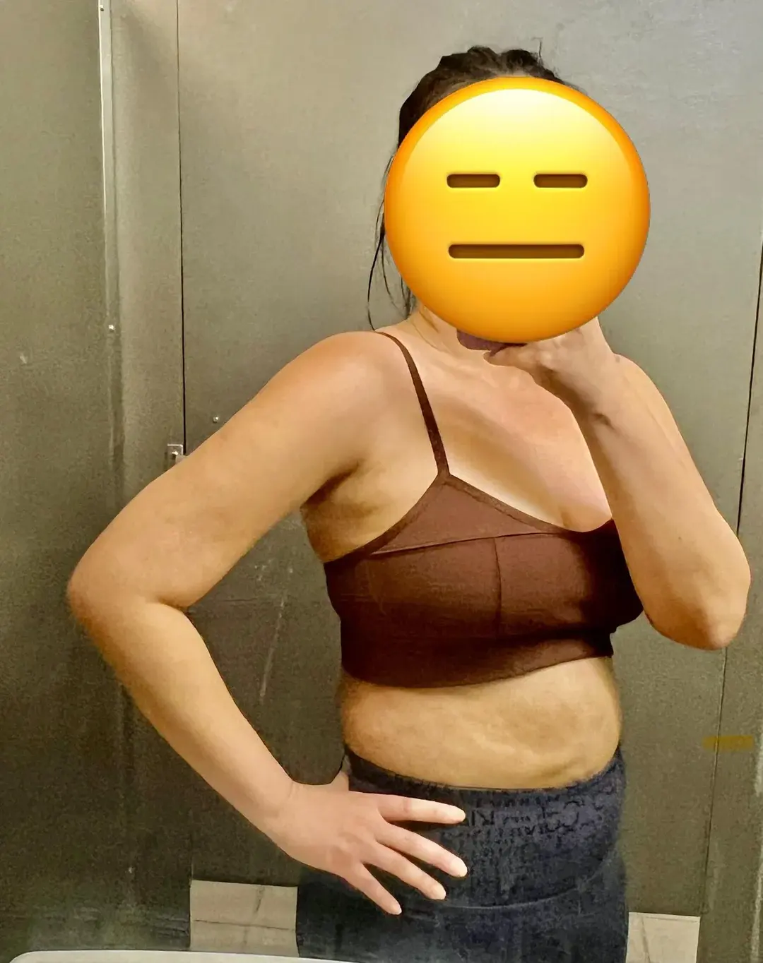 I'M Plastic Surgery — 5