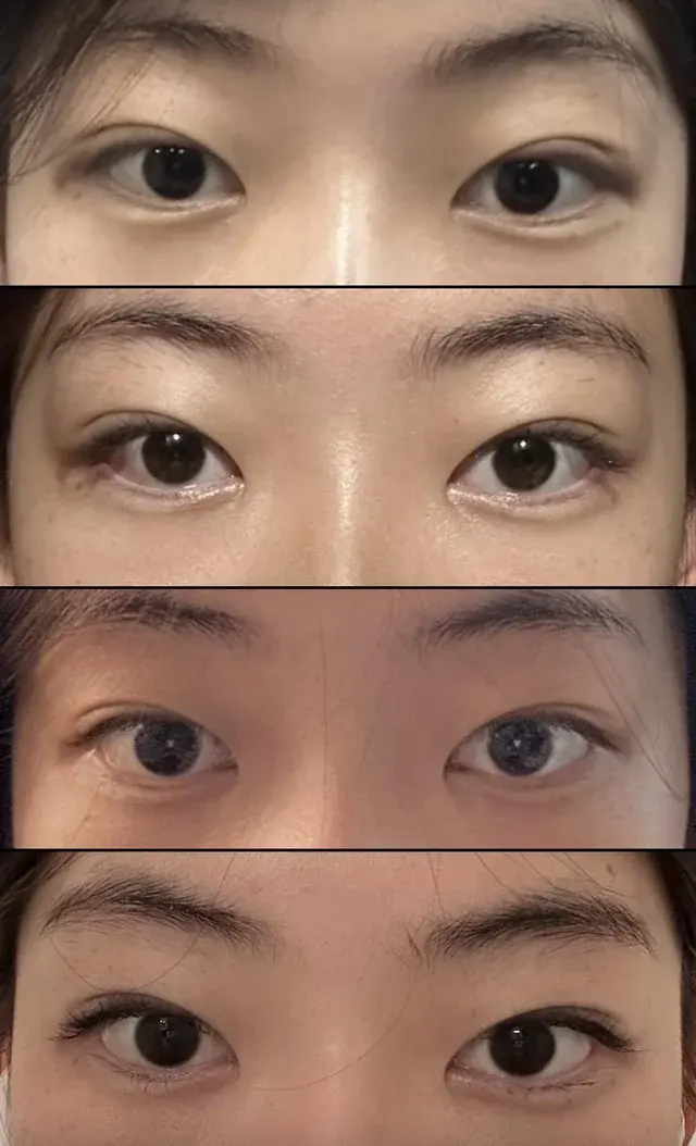 Marble Plastic Surgery — 2