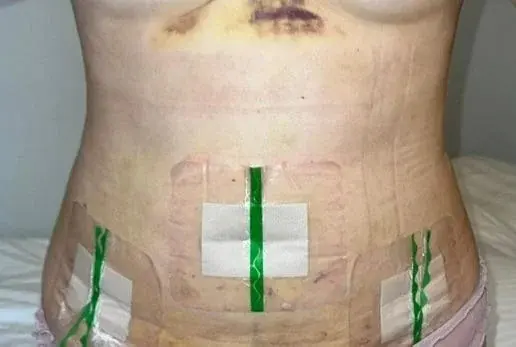 GIRIN Plastic Surgery Clinic — 2