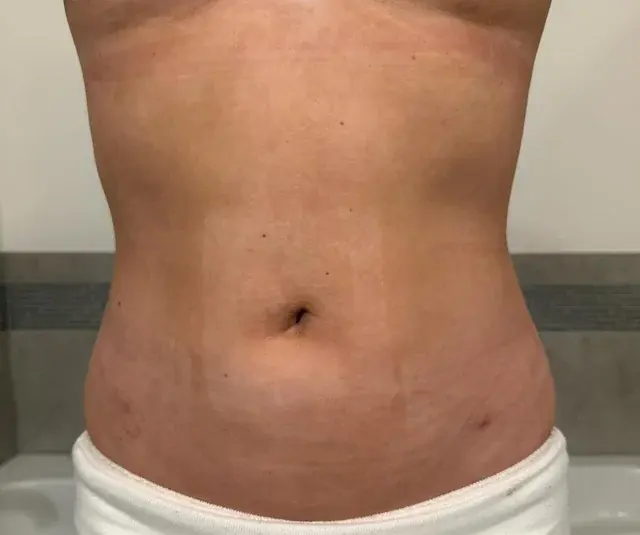 GIRIN Plastic Surgery Clinic — 3