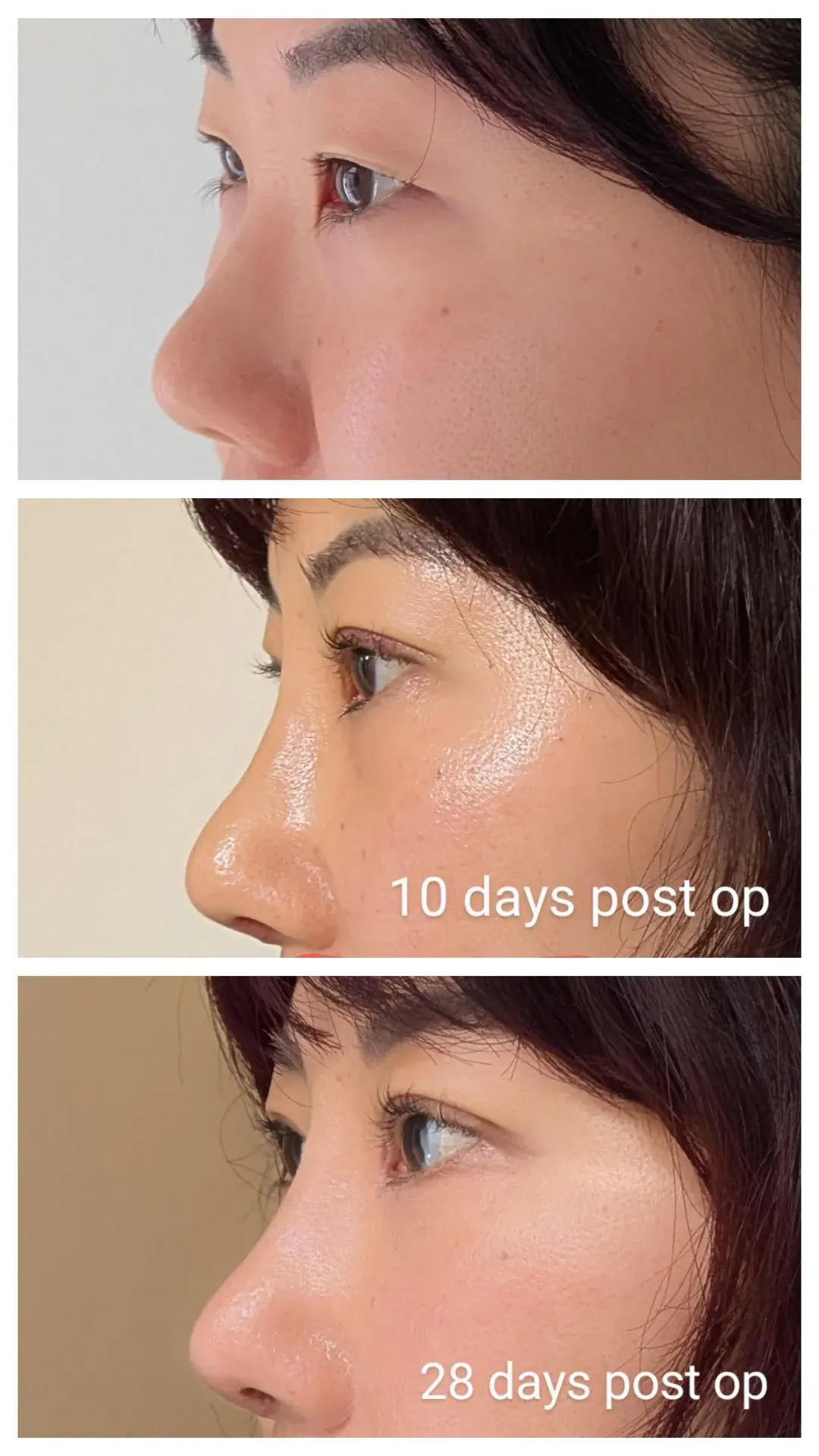 Topface Plastic Surgery — 1