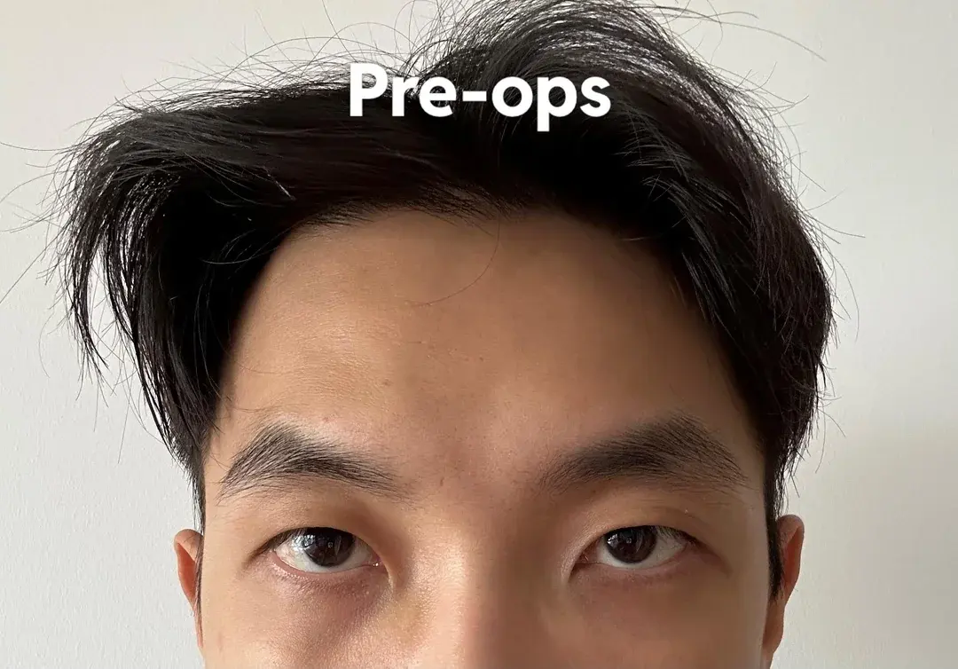 Gift Plastic Surgery — 1