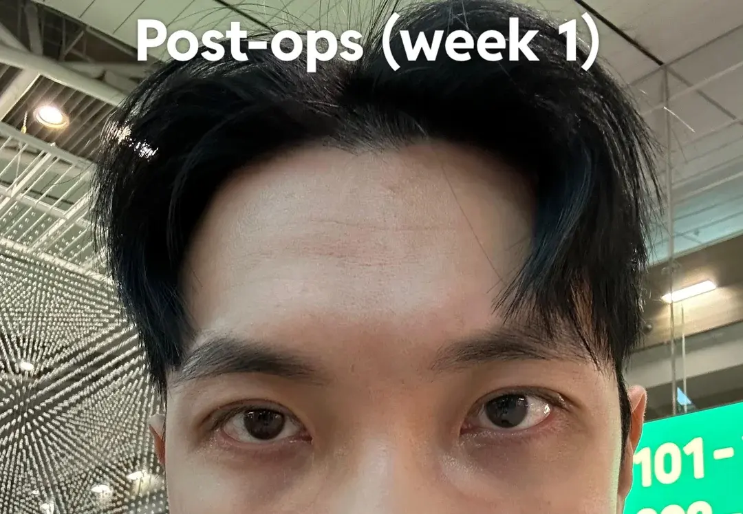 Gift Plastic Surgery — 3