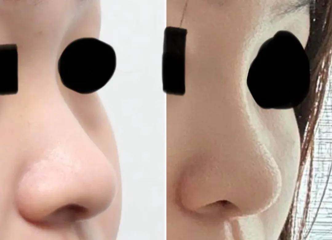 BT Plastic Surgery — 1