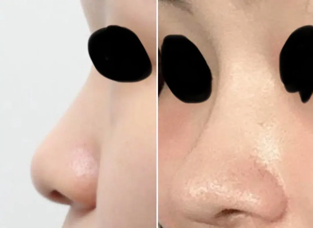 BT Plastic Surgery — 2