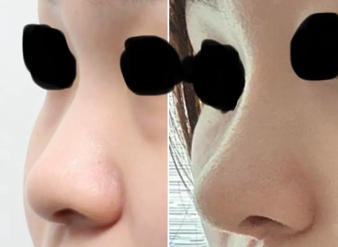 BT Plastic Surgery — 3