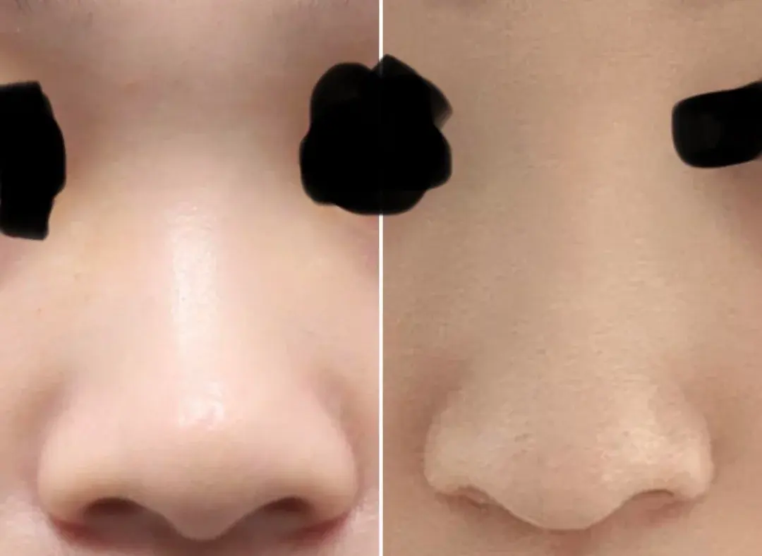 BT Plastic Surgery — 4