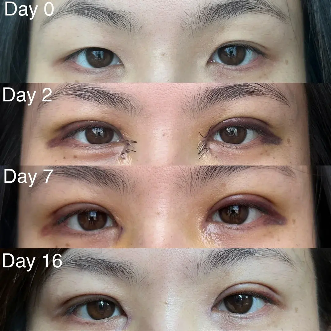 Wink Plastic Surgery — 1
