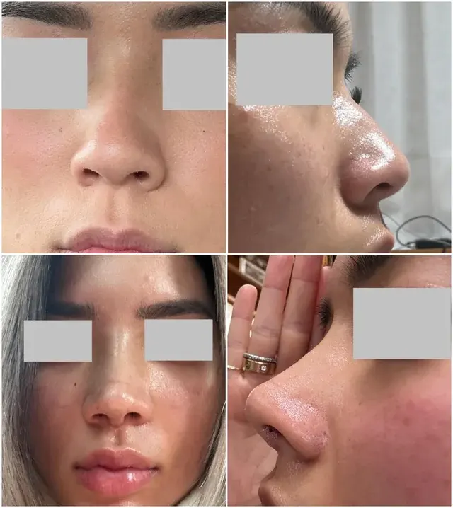 MIHO Plastic Surgery — 1