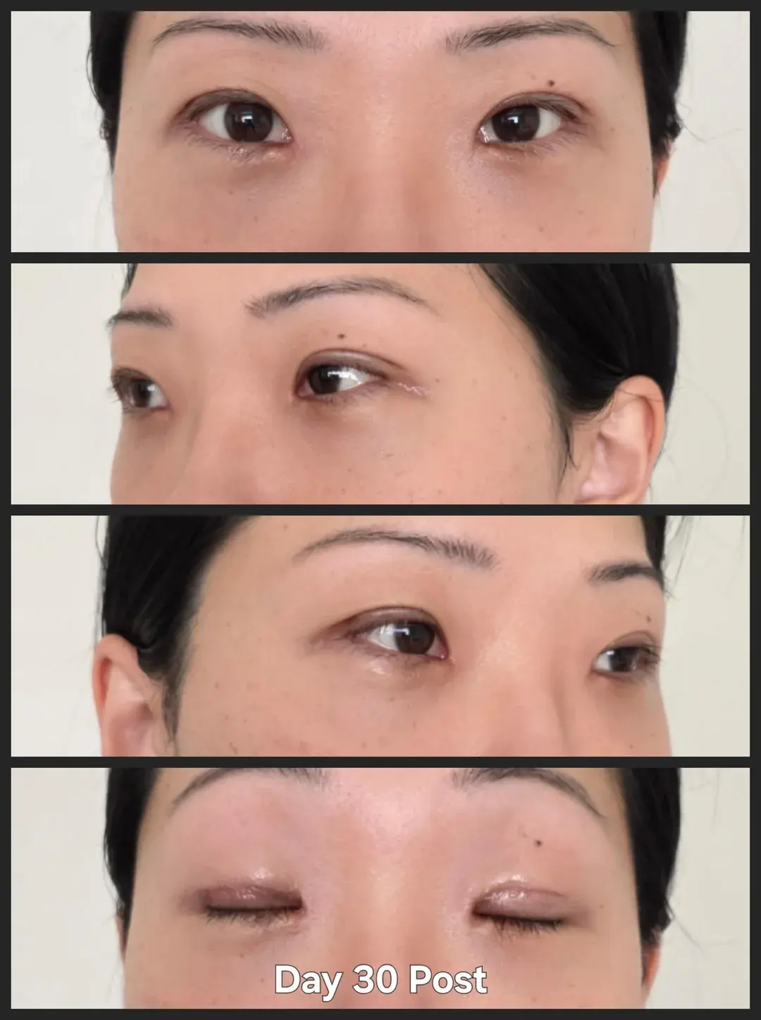 Wanna Plastic Surgery — 2