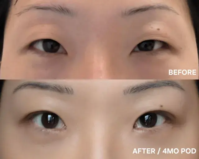 Wanna Plastic Surgery — 3