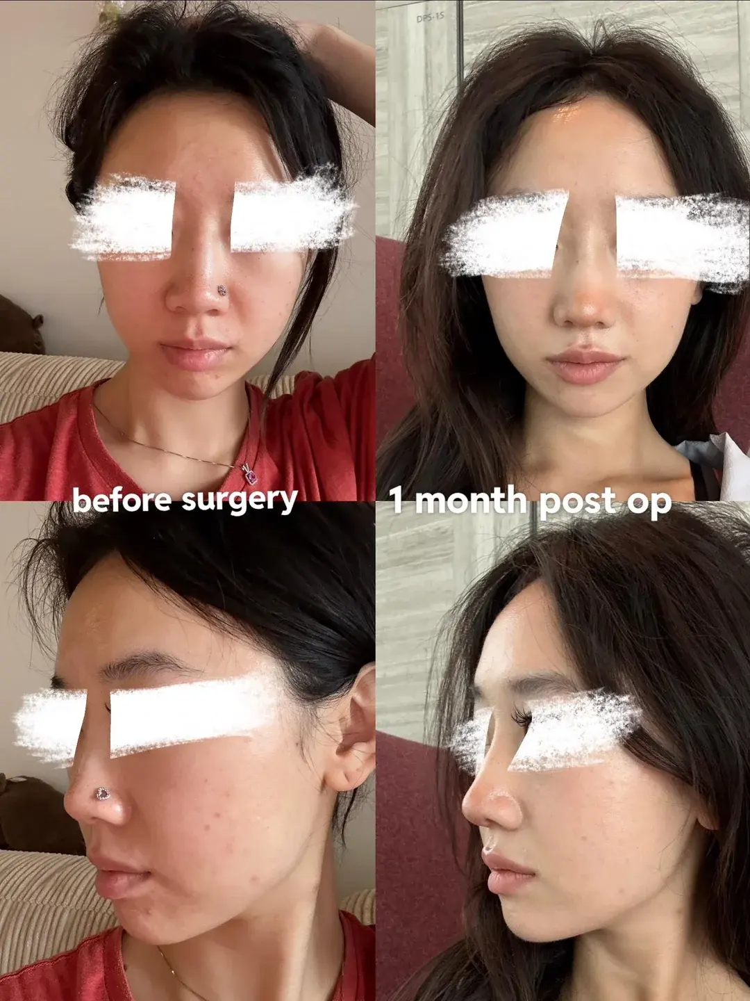 DL Plastic Surgery — 1