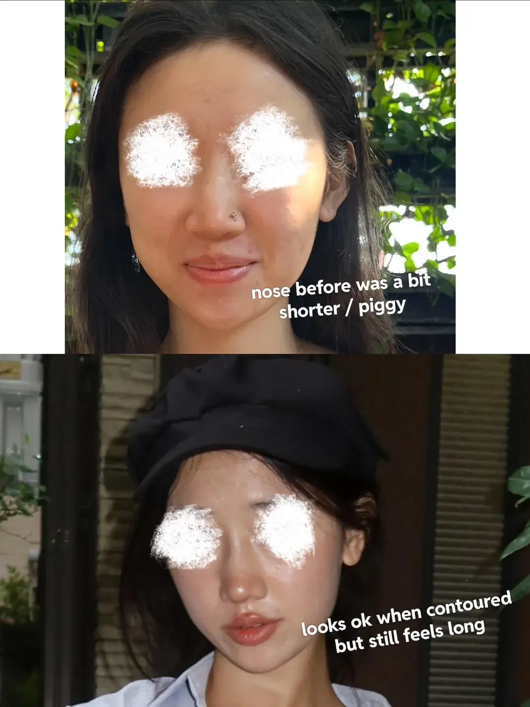 DL Plastic Surgery — 3