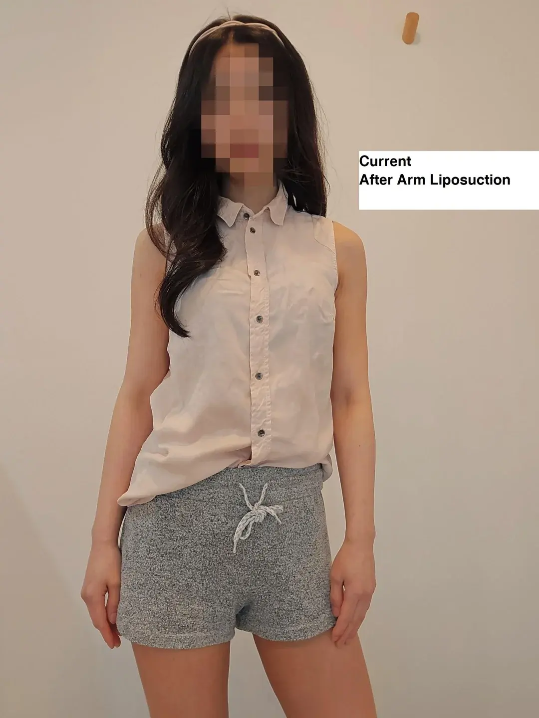 SIA Plastic Surgery — 3
