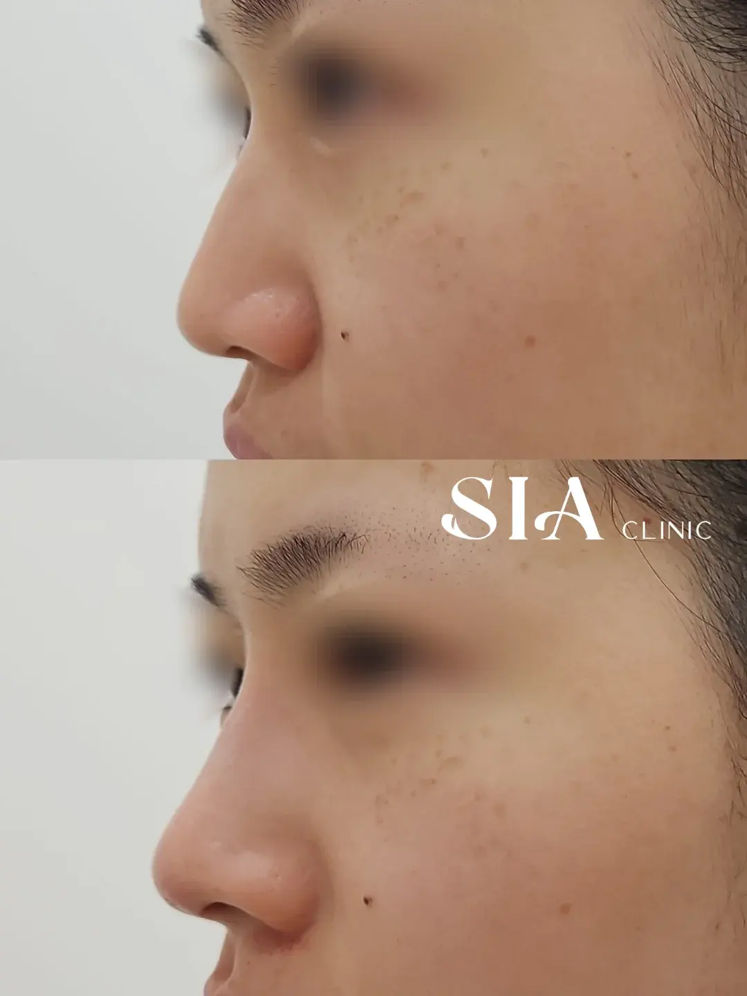 BT Plastic Surgery — 1