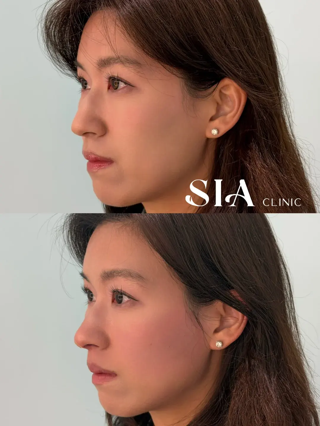BT Plastic Surgery — 2