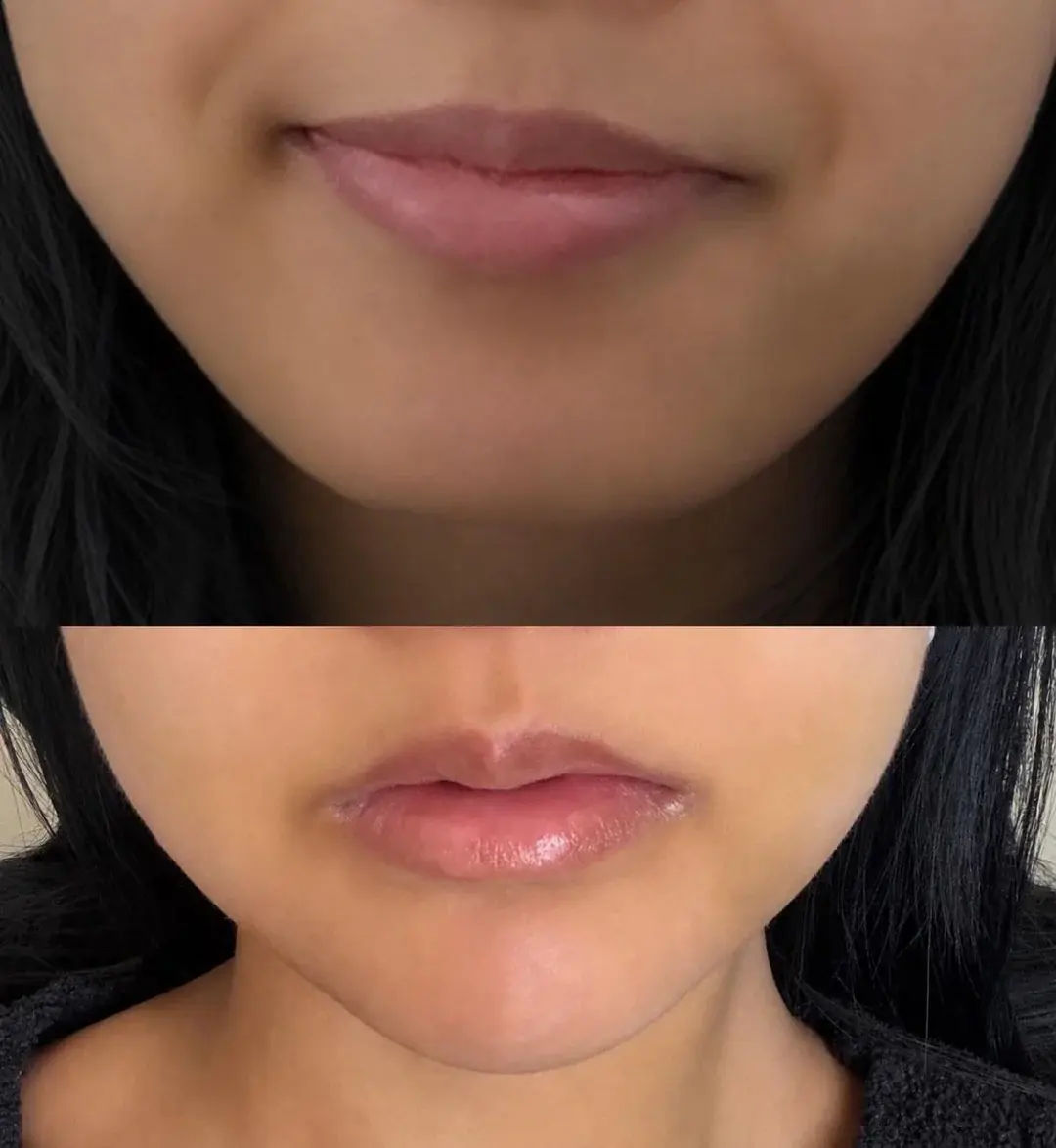 KOWON Plastic Surgery — 1