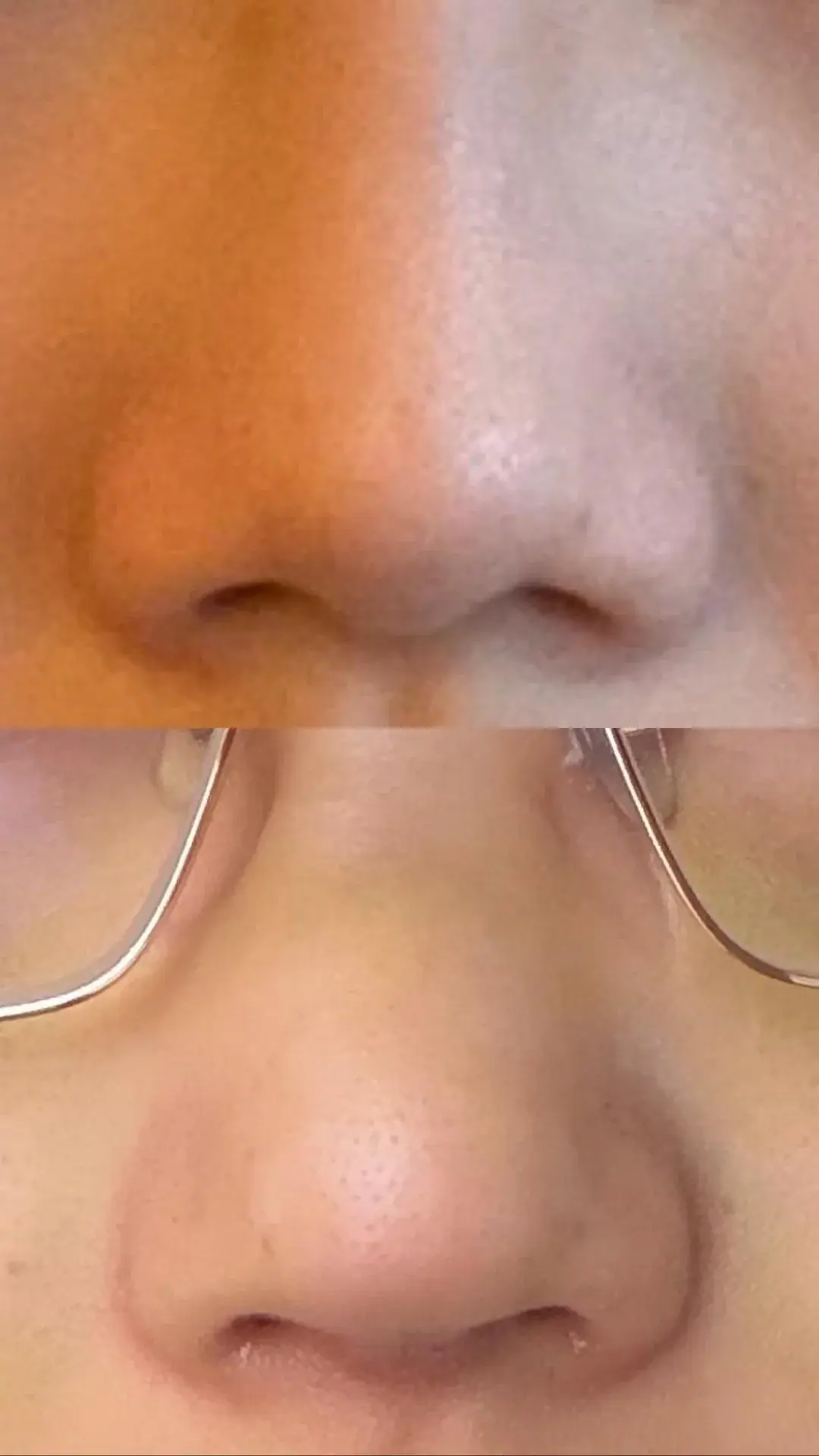 KOWON Plastic Surgery — 3