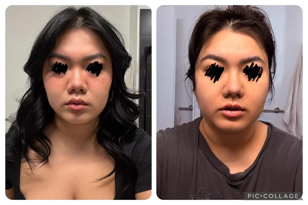 Wanna Plastic Surgery — 1