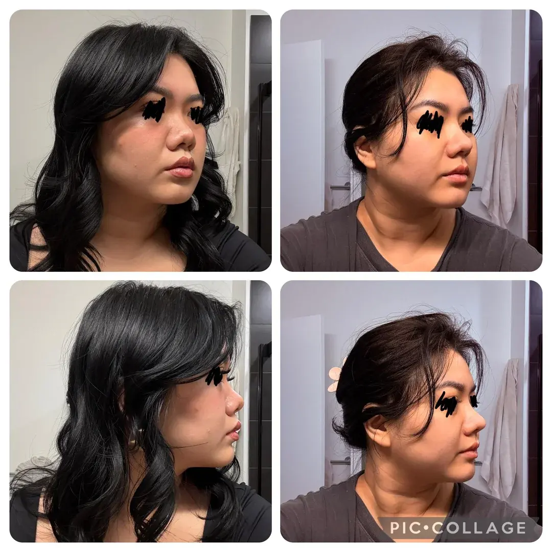 Wanna Plastic Surgery — 2