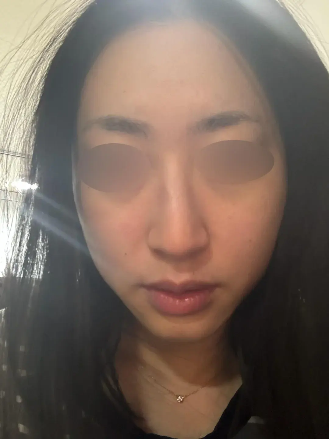 NOTE Plastic Surgery — 1