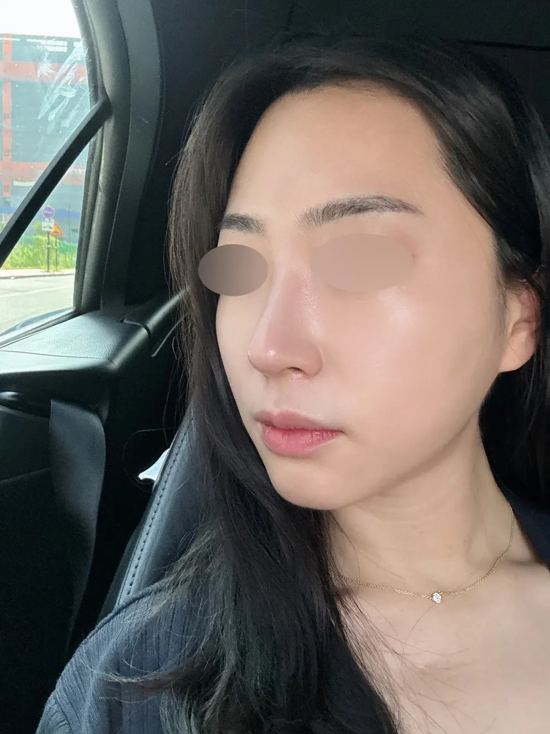 NOTE Plastic Surgery — 2