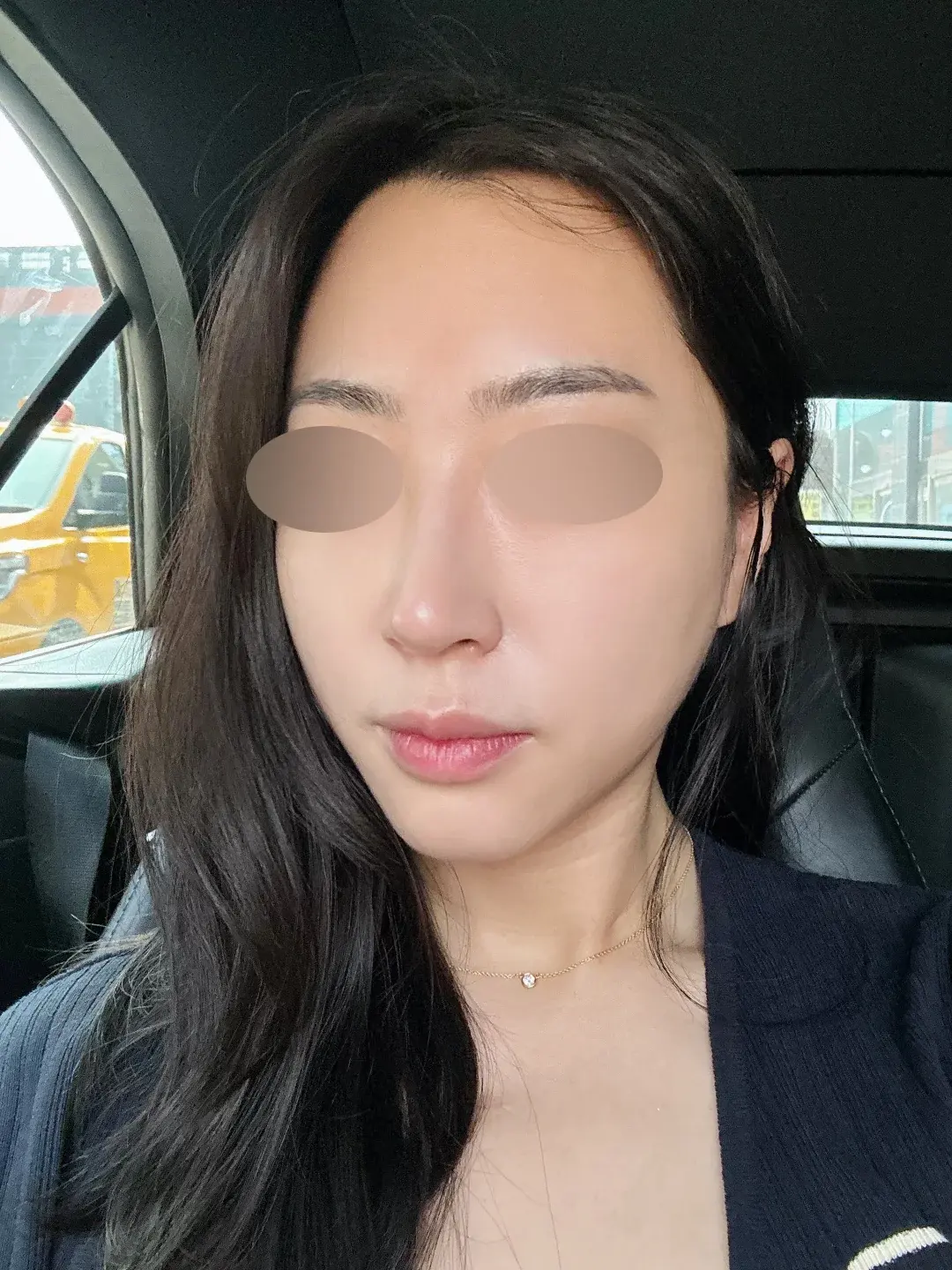 NOTE Plastic Surgery — 3