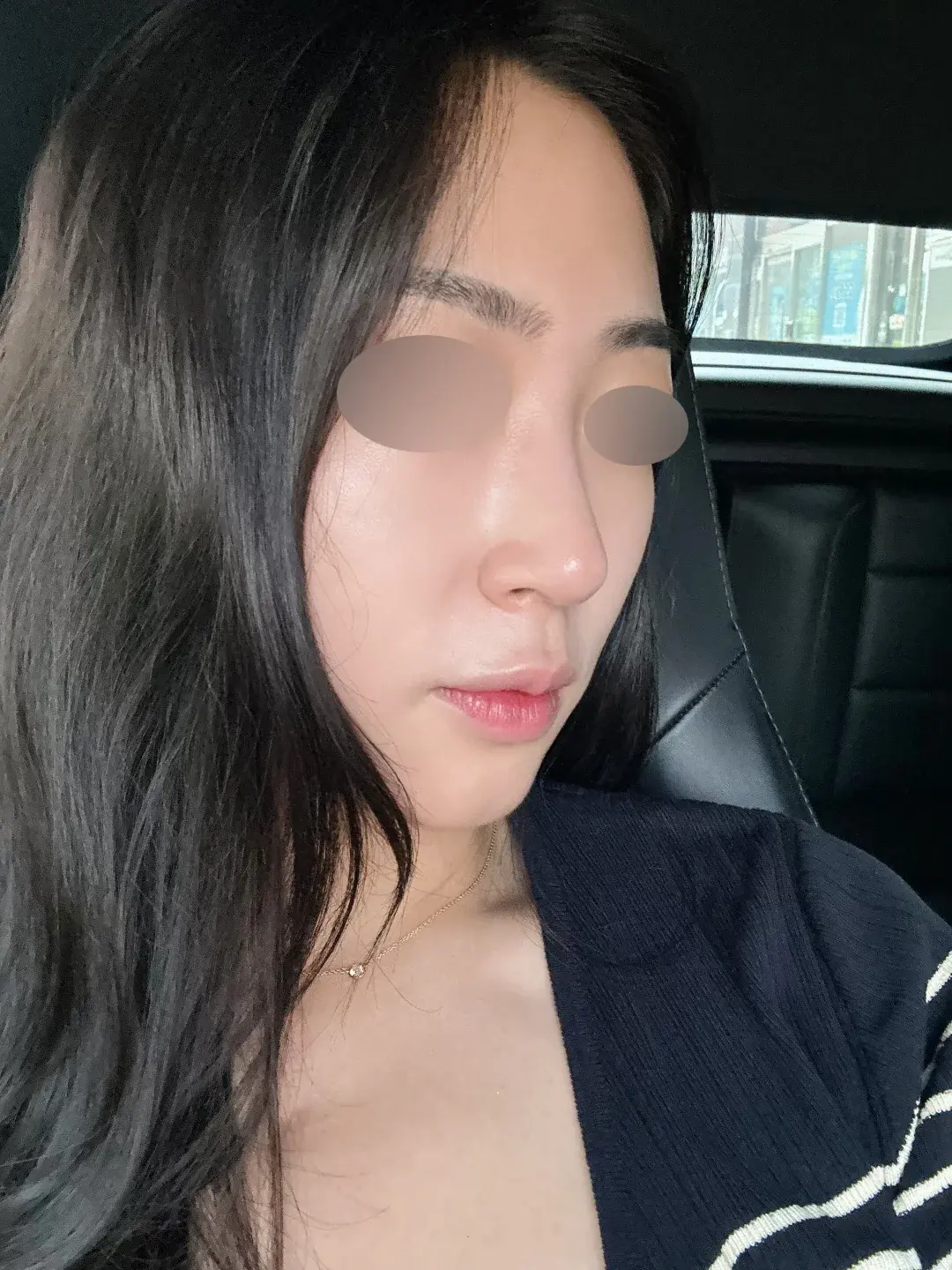 NOTE Plastic Surgery — 4