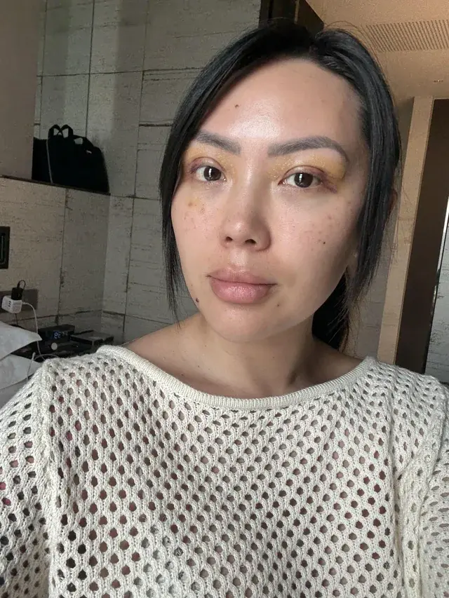 EYEFIT Plastic Surgery — 2
