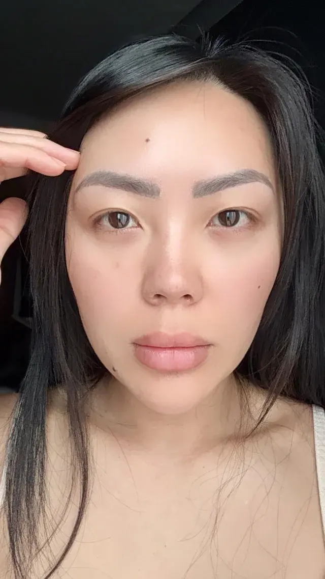 EYEFIT Plastic Surgery — 3