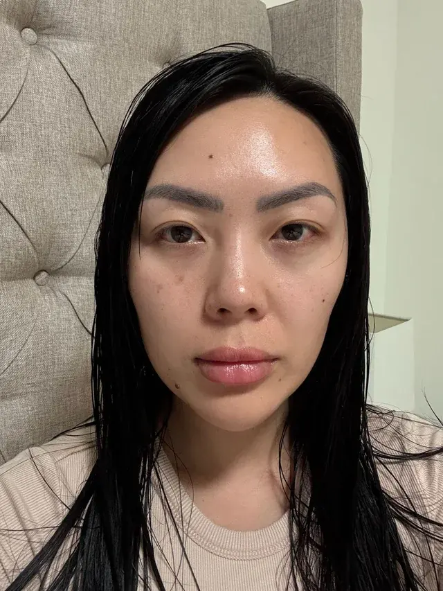 EYEFIT Plastic Surgery — 4