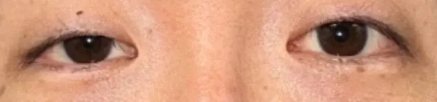 Thank You Plastic Surgery — 1