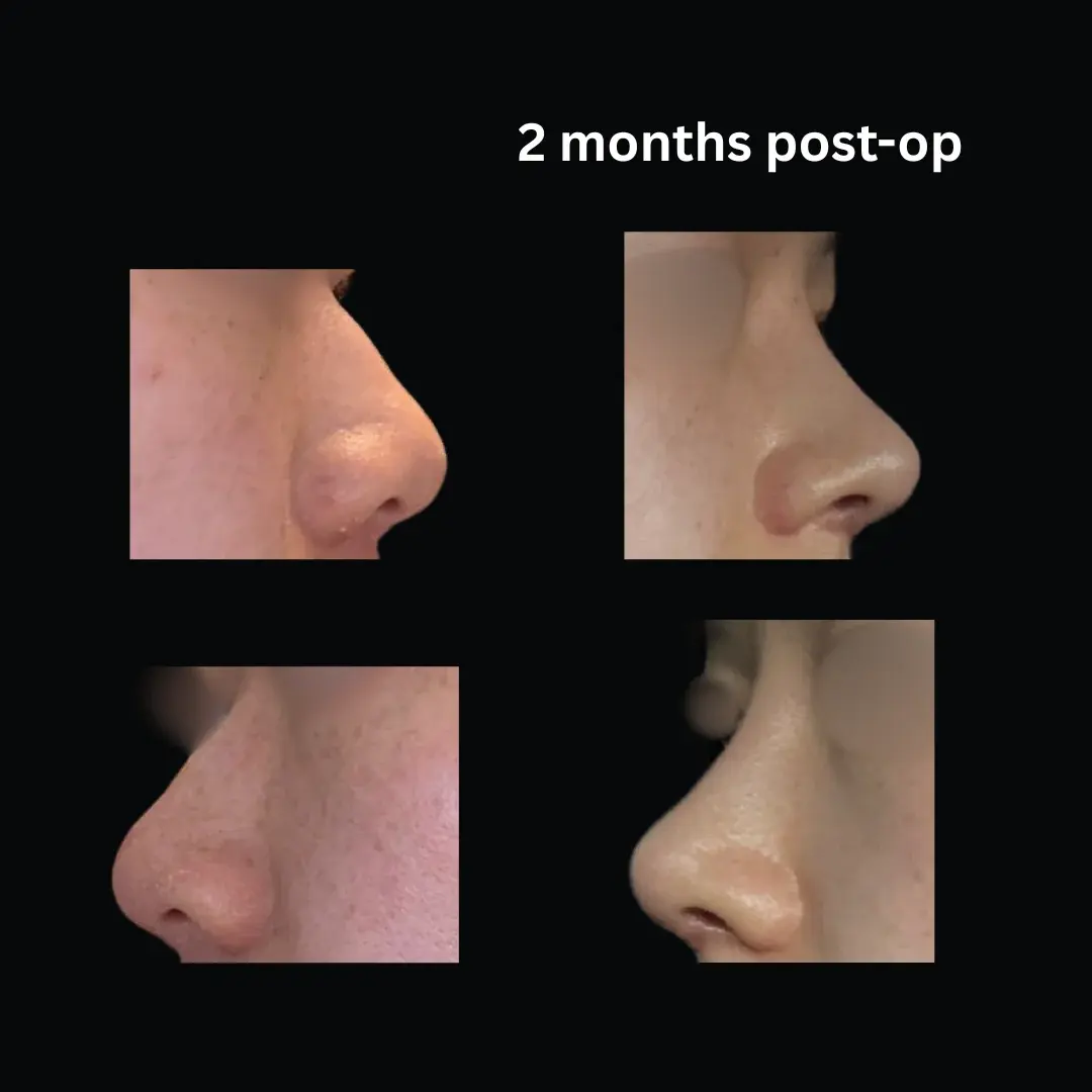 MIHO Plastic Surgery — 1
