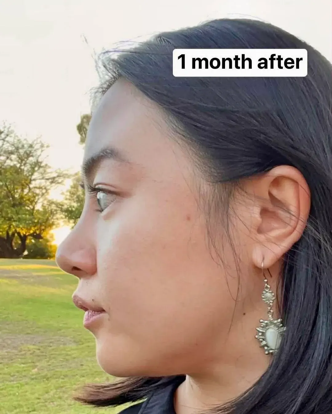 SUGAR Plastic Surgery — 2