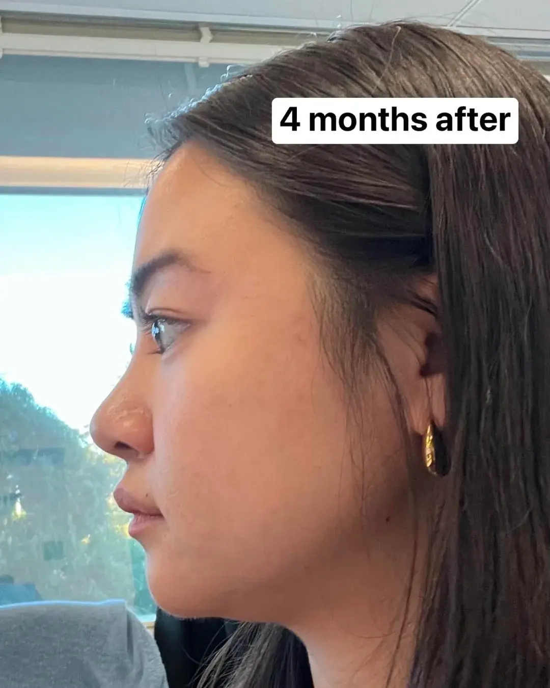 SUGAR Plastic Surgery — 3