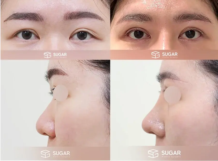 BBAE Clinic — 1