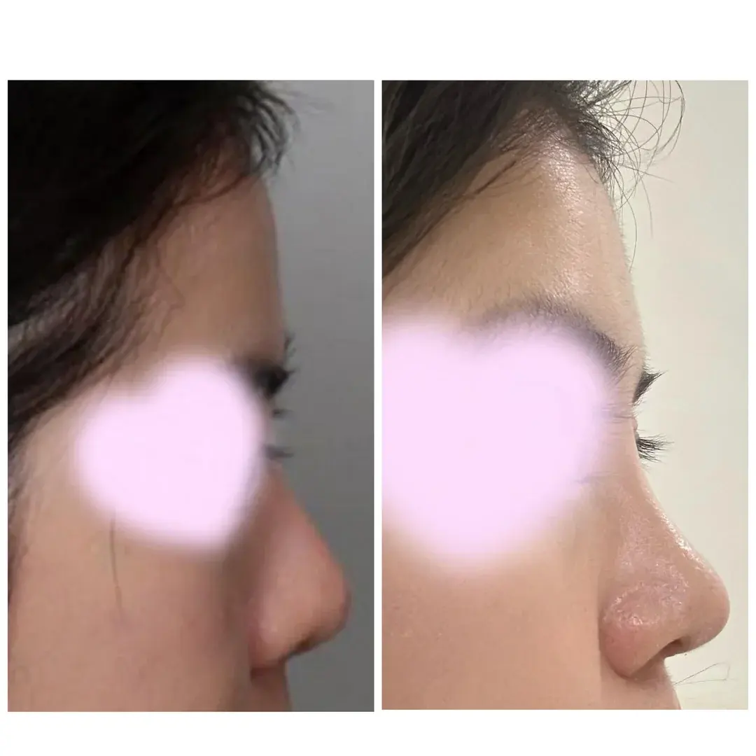 Another Plastic Surgery — 1